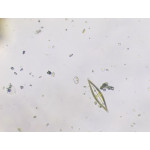 Diatoms