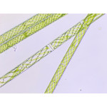 Spirogyra