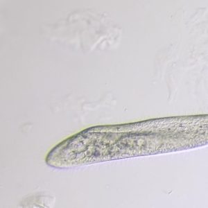 Paramecium Caudatum
