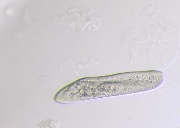 Paramecium Caudatum