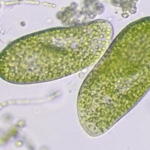 Paramecium Bursaria