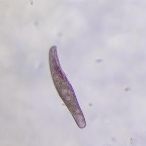Blepharisma