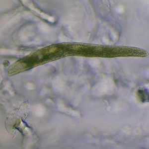 Spirostomum