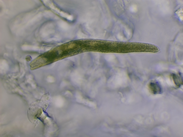 Spirostomum