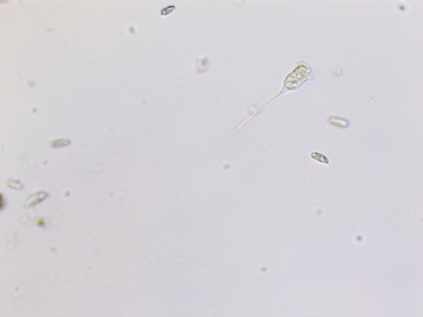 Vorticella