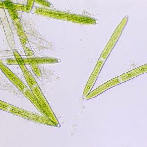 Closterium