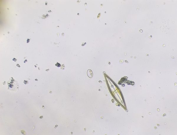 Diatoms