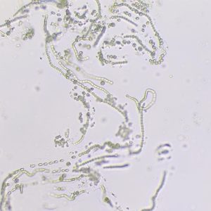 Nostoc