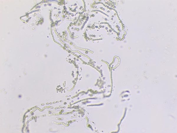 Nostoc
