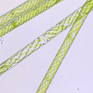 Spirogyra