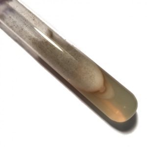 Rhizopus Stolonifer